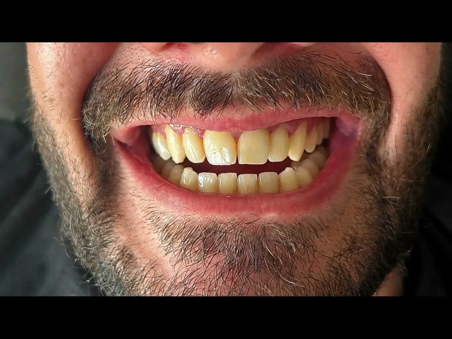 Smile Edit & Nailys Beauty - Onglerie Villefranche-sur-Saône - Smile Edit & Nailys Beauty - Photo Galerie - OneBooking