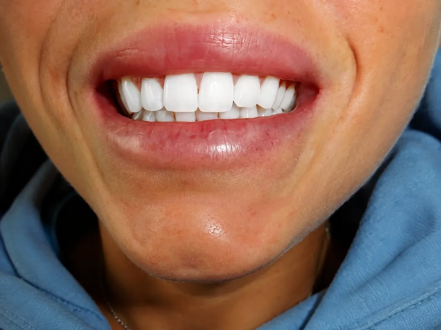 Smile Edit & Nailys Beauty - Onglerie Villefranche-sur-Saône - Smile Edit & Nailys Beauty - Photo Galerie - OneBooking