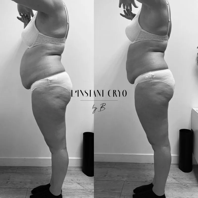 Amincissement Bastia - Cryolipolyse - L'Instant Cryo Bastia - Massage Bastia - OneBooking