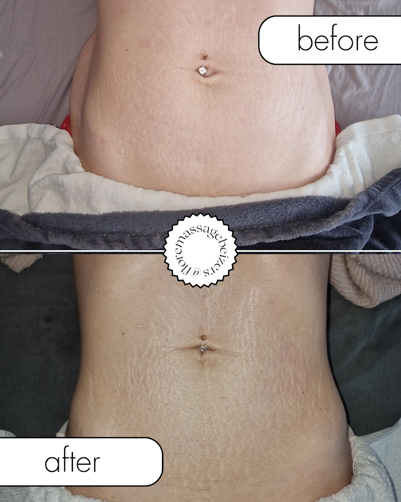 Flore massage, drainage lymphatique et maderotherapie - Bien-être Béziers - OneBooking
