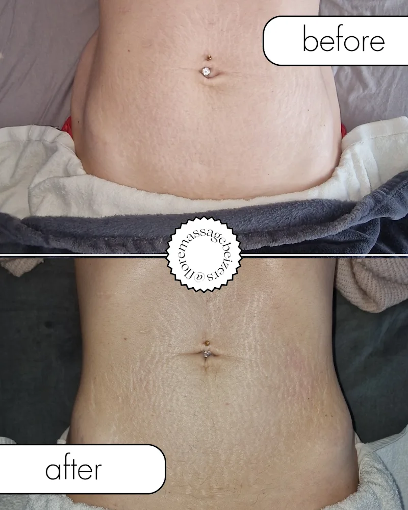 Flore massage, drainage lymphatique et maderotherapie - Bien-être Béziers - OneBooking