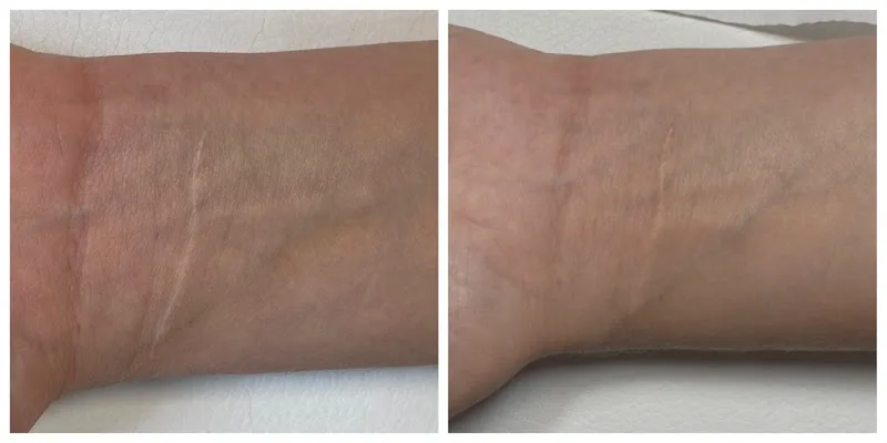 Cabinet de dermopigmentation Marie Le Gall - Maquillage Rennes - OneBooking