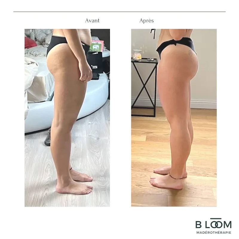 Bloom Maderothérapie - Spa Rouen - OneBooking
