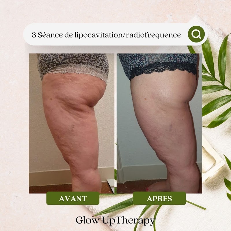 Glow UpTherapy - Bien-être Béziers - OneBooking